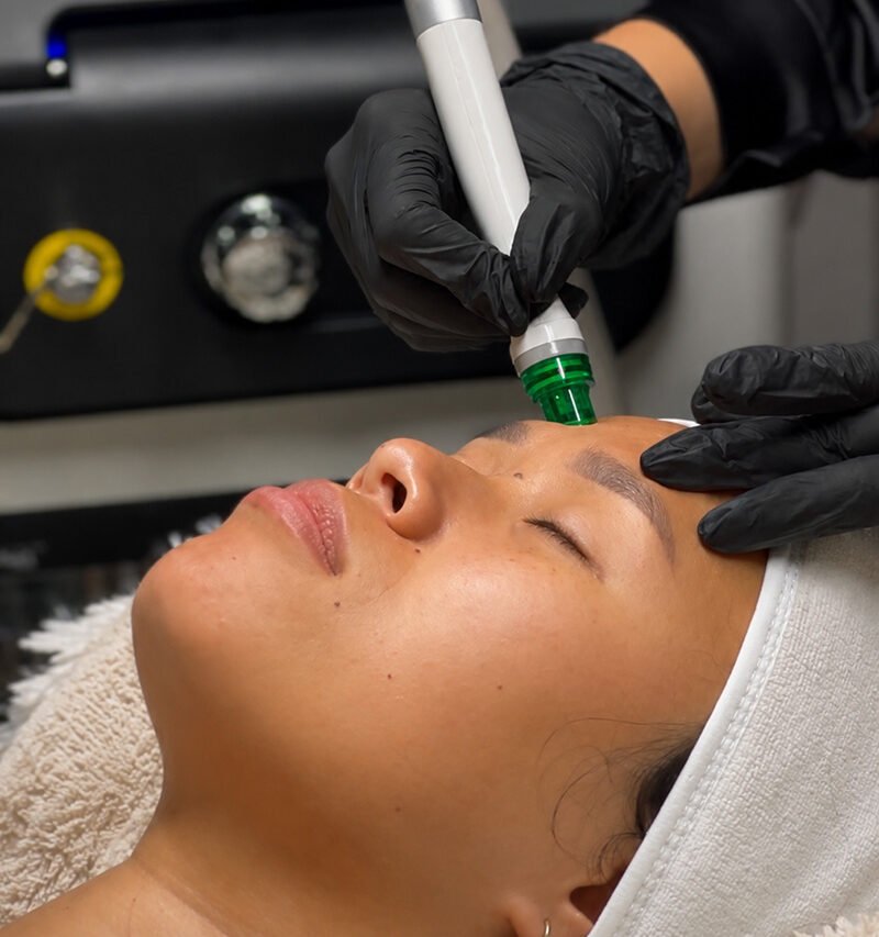 hydra glow peel LaserMe